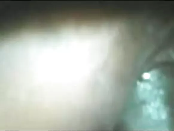 ශ්රී ලංකාවේ වයසක පුකට දීපිකා සරාගී චිත්රපටයක් වන ආදි පිරිමි ළමයා (විහිළු) ගෙන් මී පැණි සමඟ ප්රතිකාර ලබයි